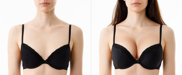 New Bestro Oil For Women’s Chest Buy 1 Get 1 Free